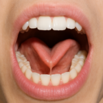 chat gpt image of a tonge tie with white teeth and tonge
